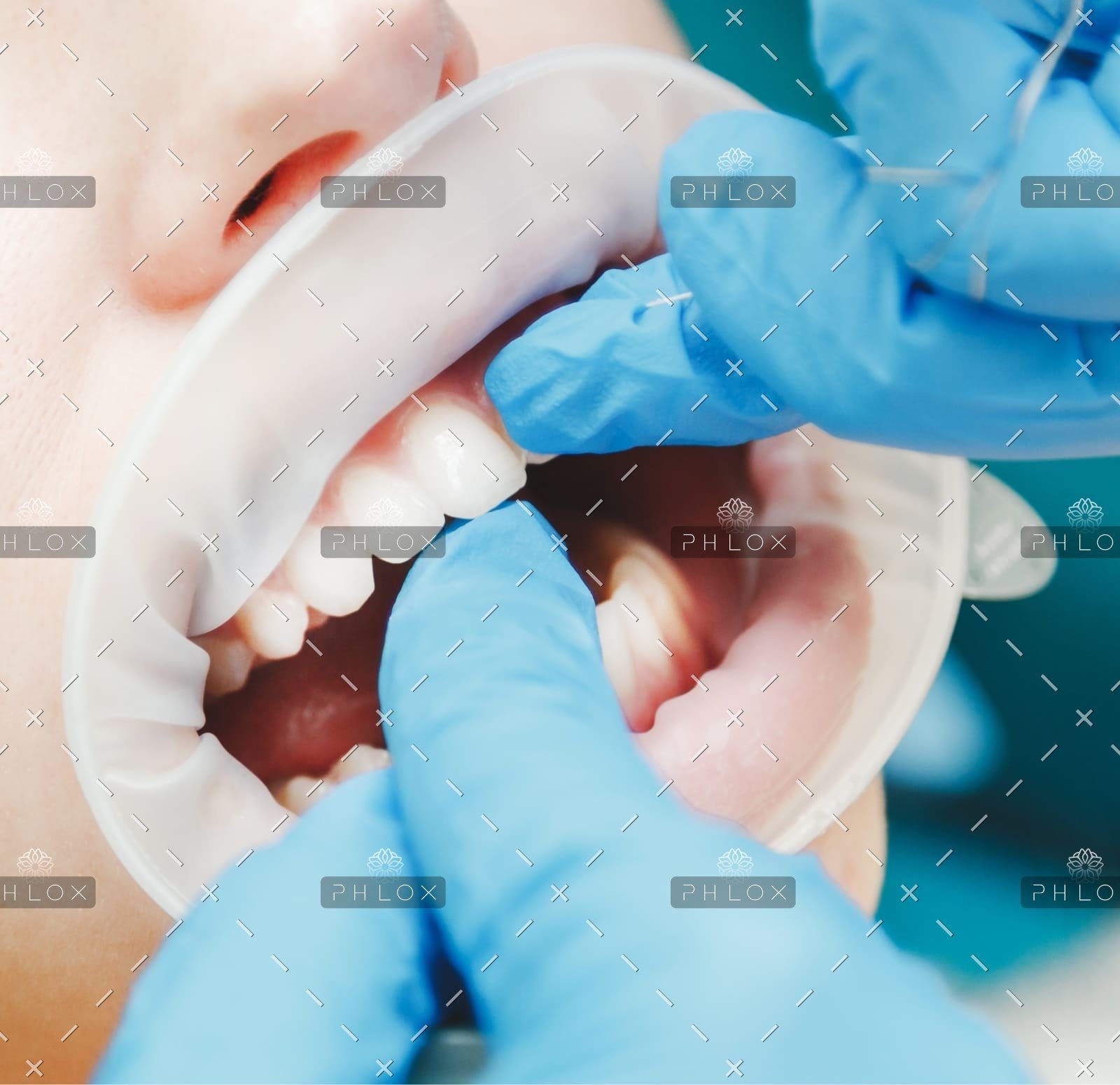 Taylor Life in Other Word